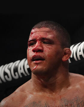 Gilbert Burns of Brazil reacts after the conclusion of his battle against Khamzat Chimaev in their welterweight fight during the UFC 273 event at VyStar Veterans Memorial Arena on April 09, 2022 in Jacksonville, Florida. (Photo by Cooper Neill/Zuffa LLC)